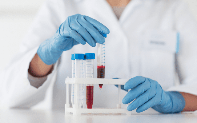 MM-HealthCorner-listing image-covid19-antibody-test